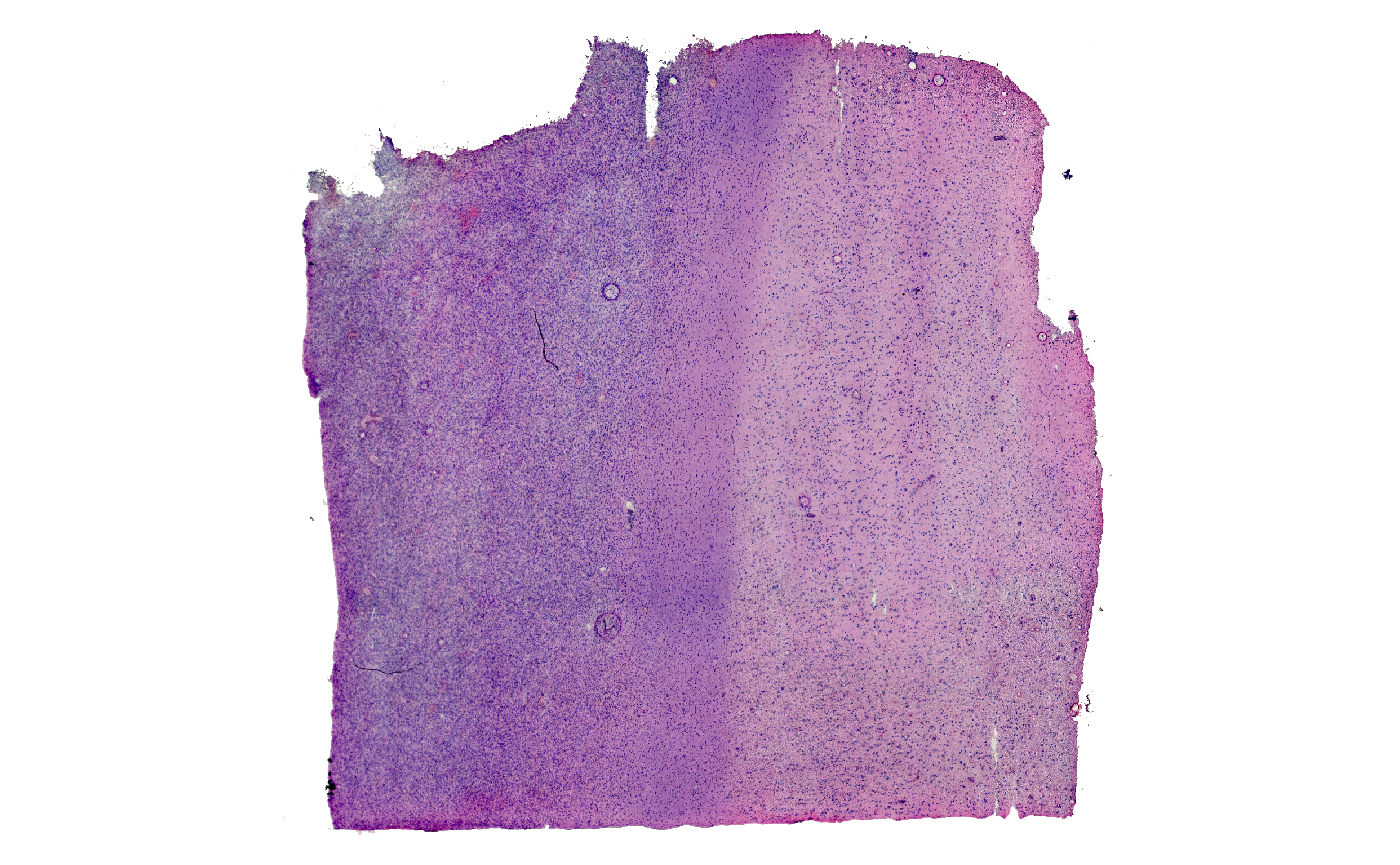 Fig.1 The example sample raw and colored by histological classification.