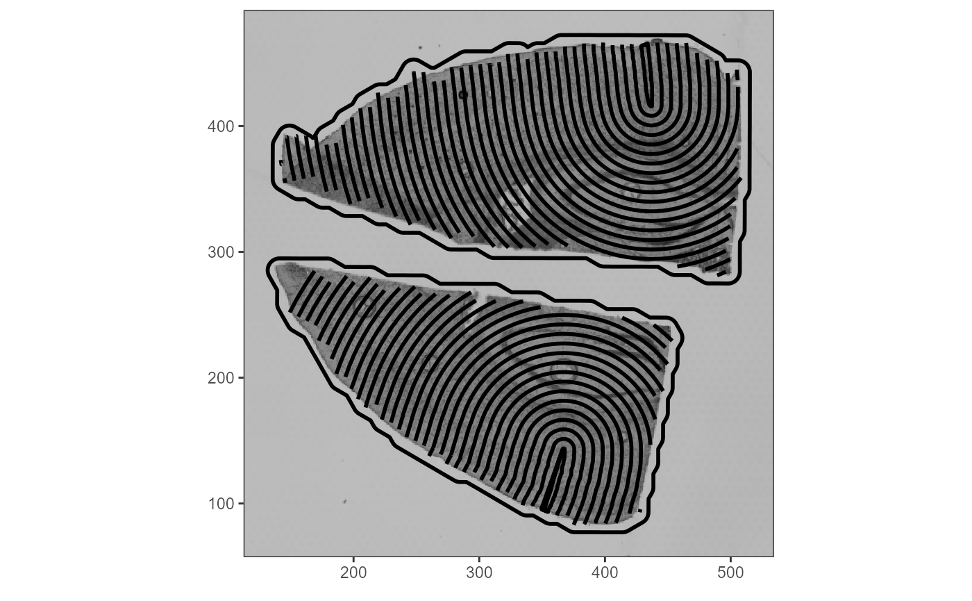 Fig.6 Visualization of how SPATA2 considers the outline of actual tissue sections within algorithms.