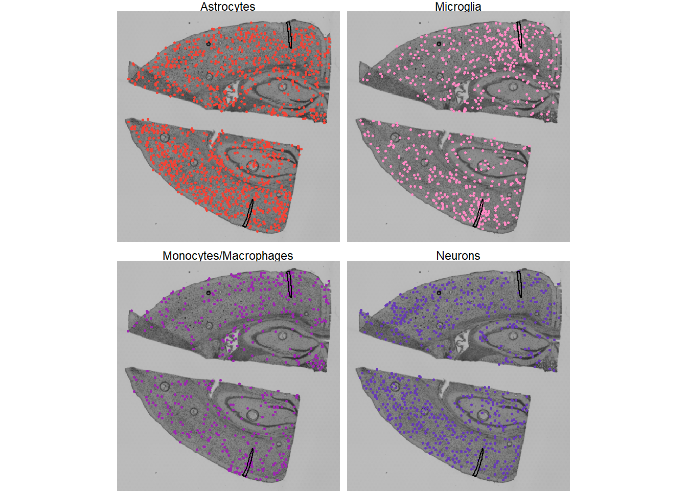 Fig.2 Single cells of different cell types plotted on histology.